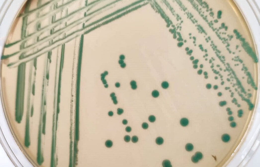 Listeria monocytogenes