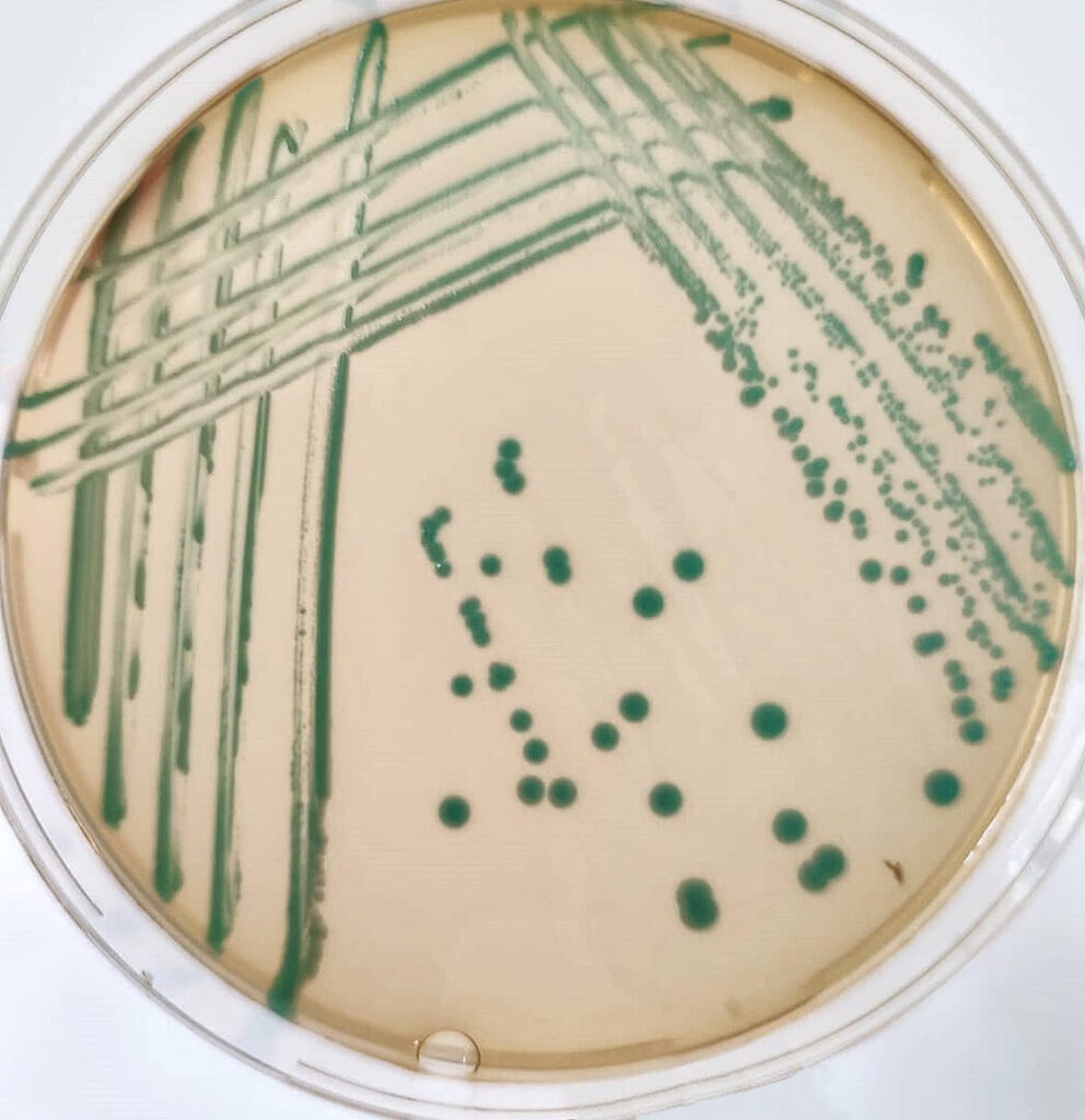 Listeria monocytogenes